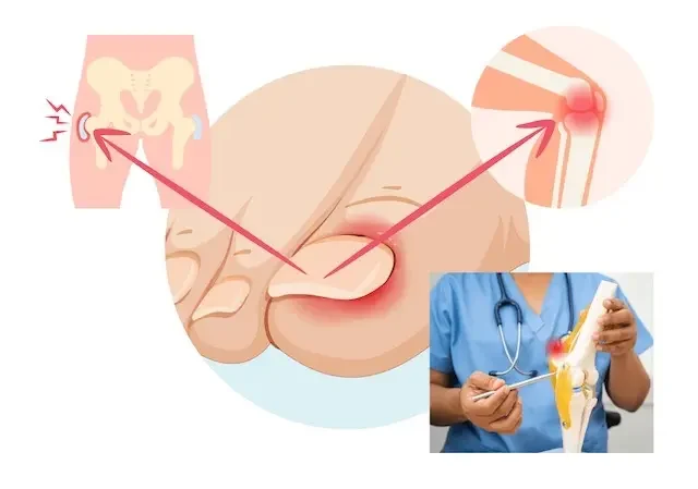  verdickte Zehennägel kein Pilz, Jenn Cosmetic