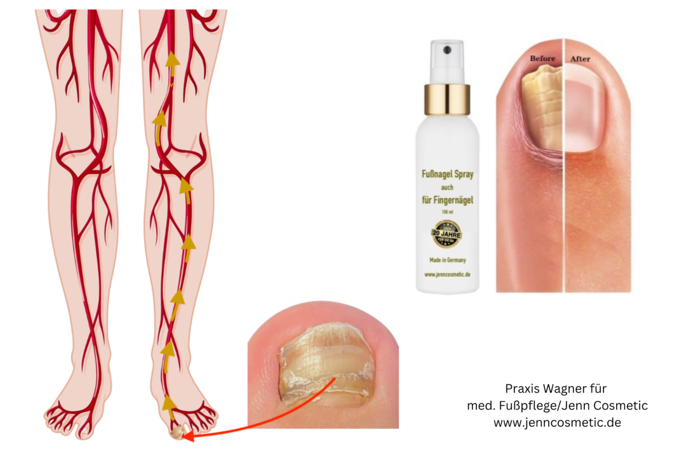 nagel-loest-sich-vom-nagelbett-jenncosmetic