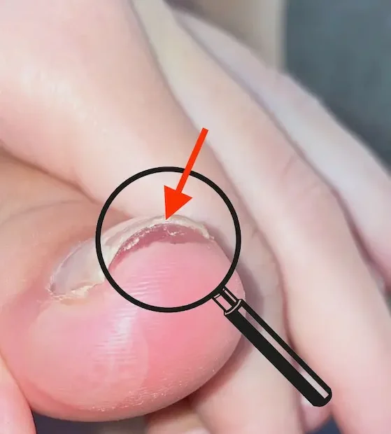 sieht-aus-wie-nagelpilz-ist-aber-keiner-jenncosmetic