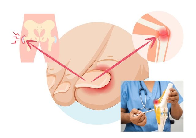  verdickte Zehennägel kein Pilz, Jenn Cosmetic