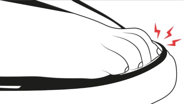 verdickte zehennägel kein pilz. 