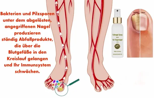 nagel loest sich vom nagelbett, jenncosmetic